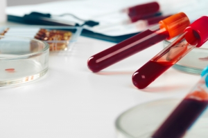 The Importance of Hormone Blood Tests in Managing Women's Health The Importance of Hormone Blood Tests in Managing Women's Health